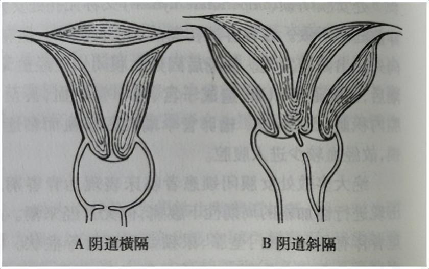 非好汉唔敢过岭钻角尖专打二数是什么生肖，详细解答、时代解答解释落实